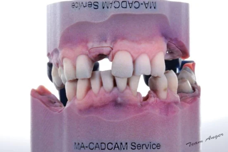 dental-model-printed-with-j5-dentajet.jpg