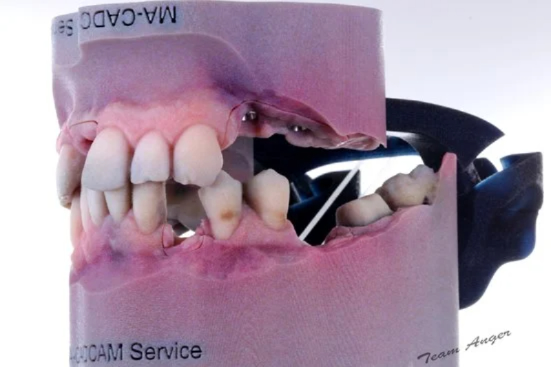 dental-model.jpg